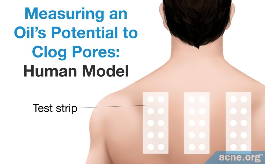 The Human Model Comedogenicity Test