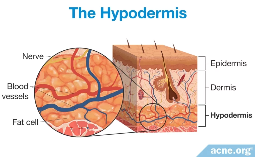 The Hypodermis
