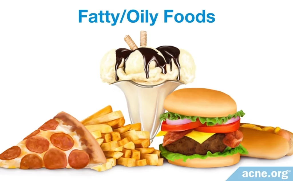 Fatty, Oily Foods and Acne