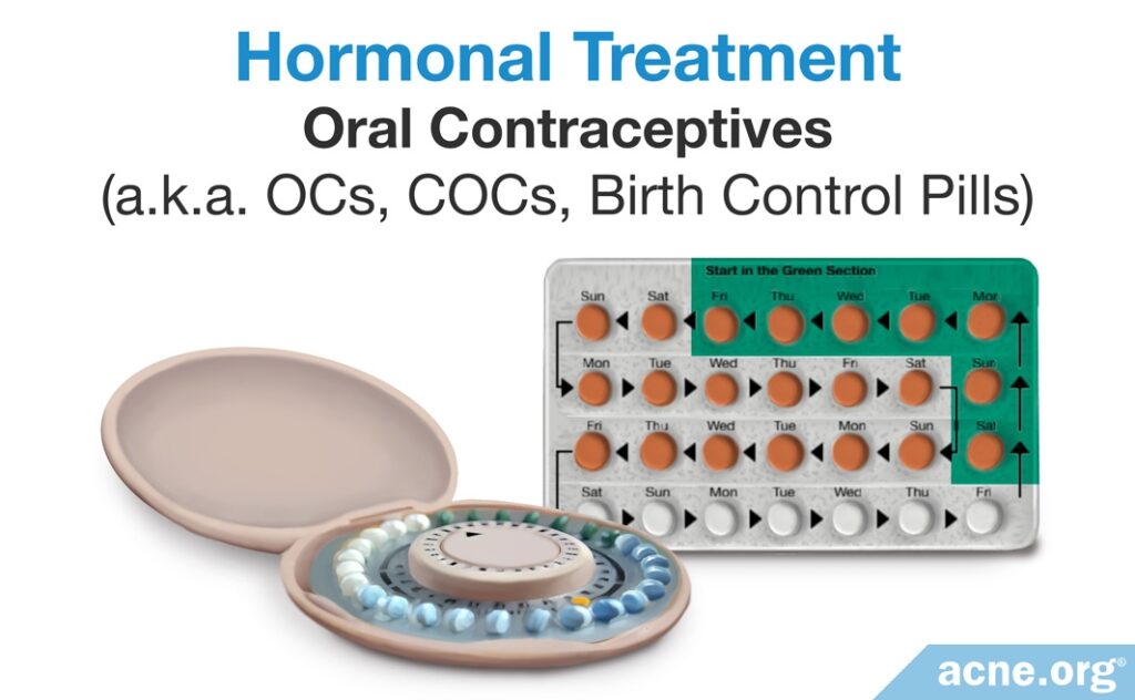 Hormonal Acne Treatment: Oral Contraceptives