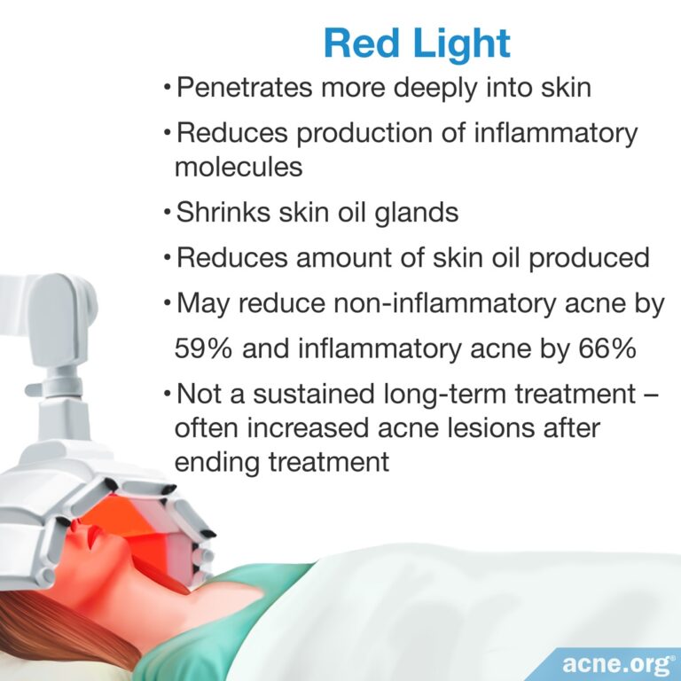 is blue or red light therapy better for acne