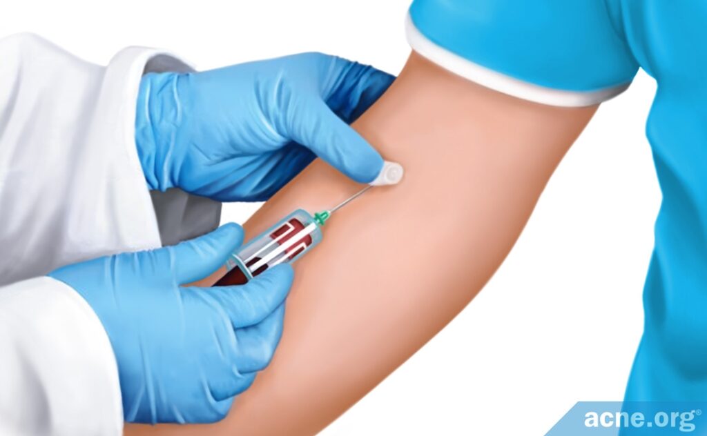 Blood Test for Zinc Levels