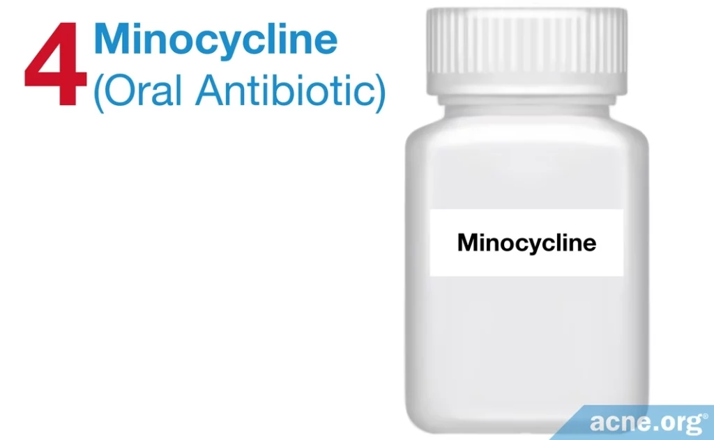Minocycline for Acne Treatment