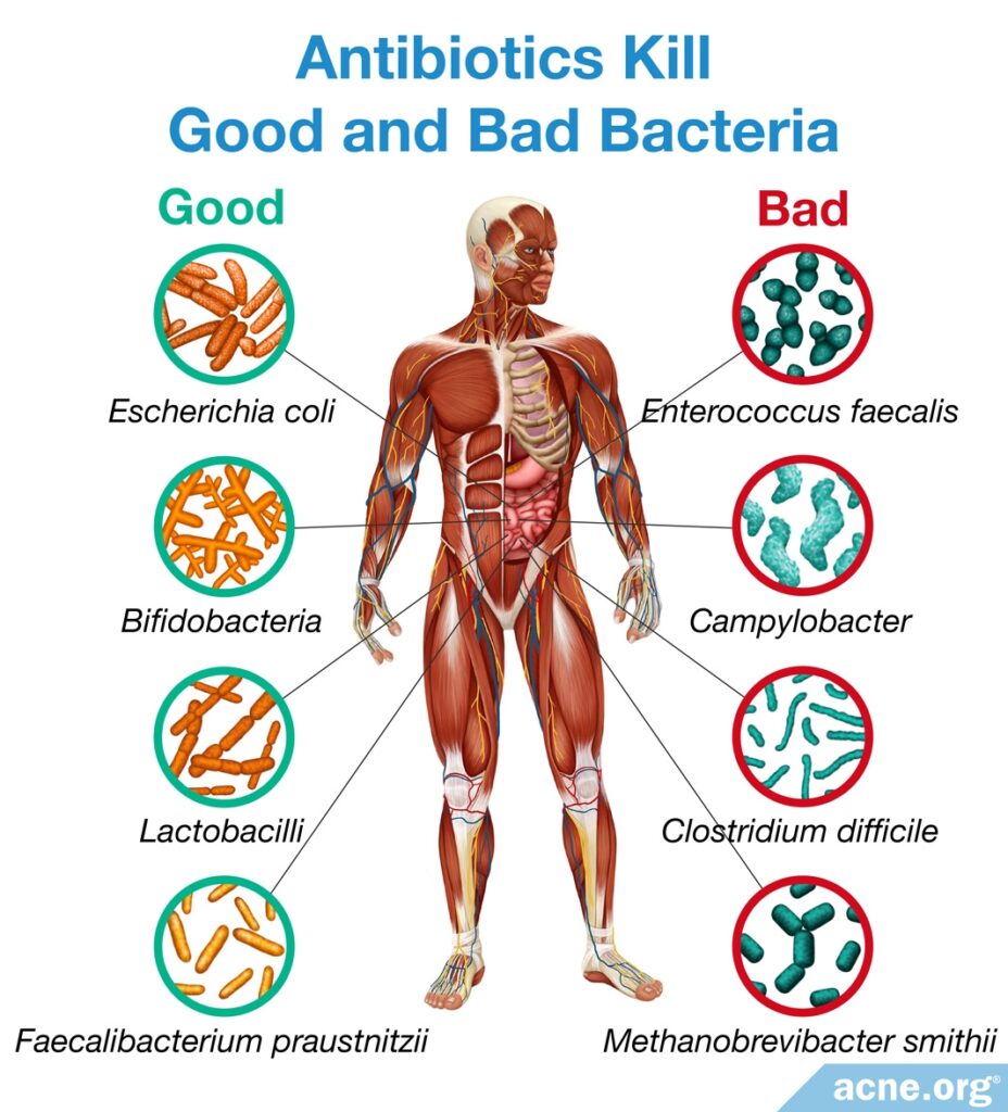 Antibiotics Kill Both Bad and Good Bacteria