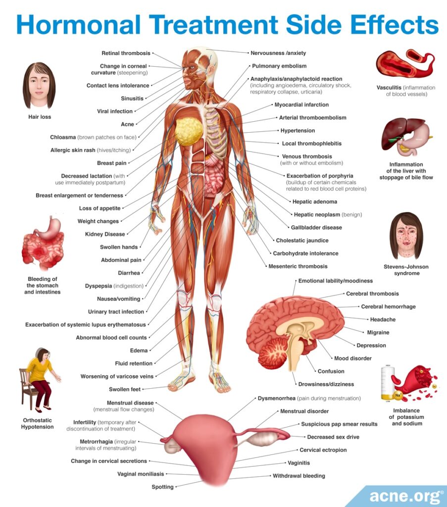 Side Effects of Hormonal Treatment