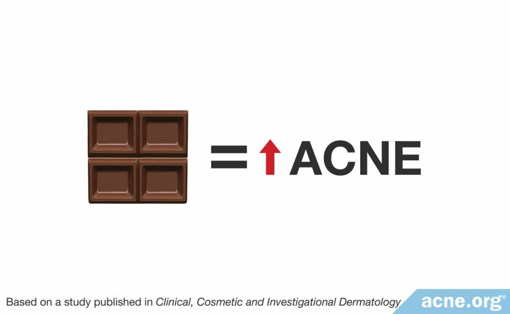Chocolate increases acne
