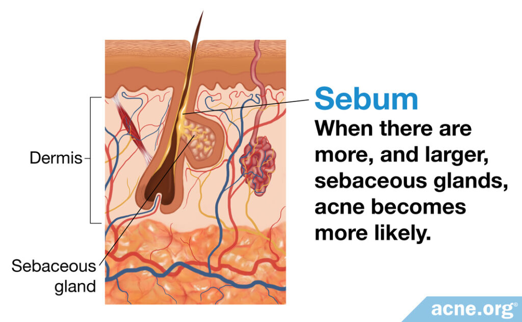 Sebaceous (Skin Oil) Gland