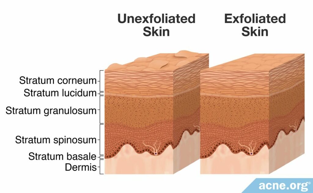 The Process of Exfoliation