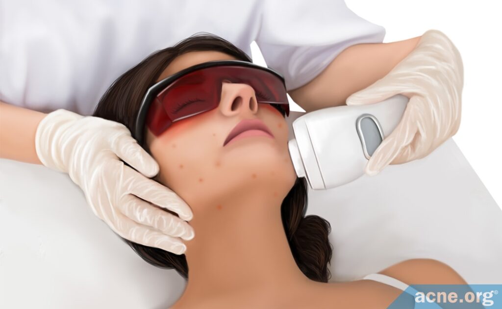 Laser Therapy