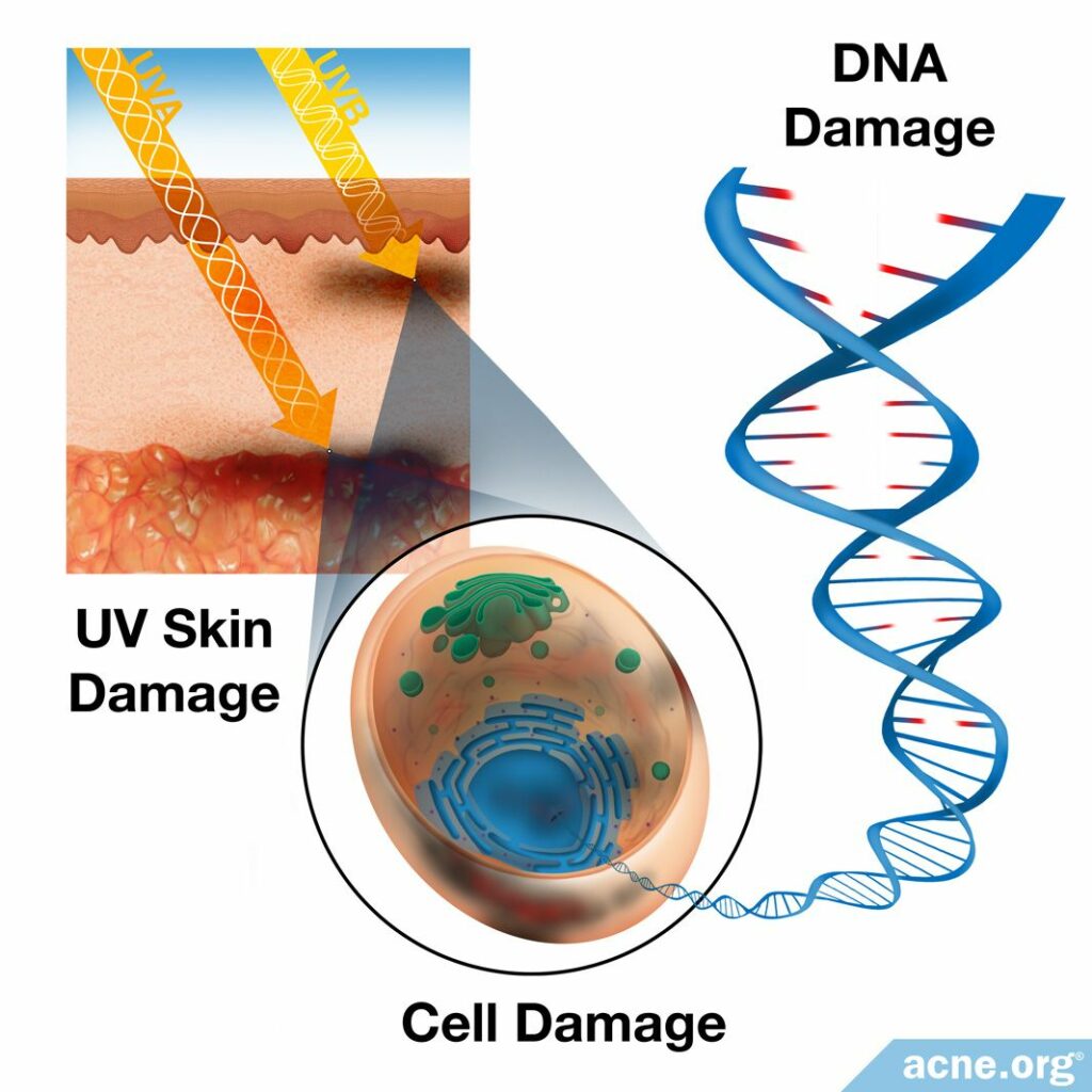 UV Skin Damage