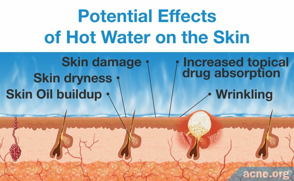 Potential Effects of Hot Water on the Skin