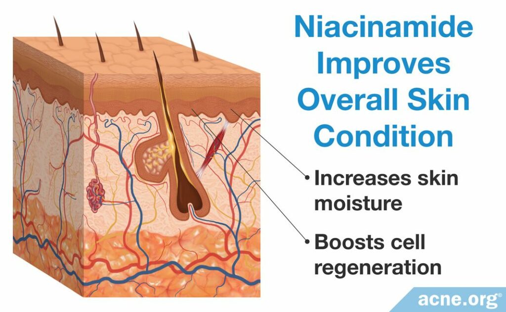 Niacinamide Improves Overall Skin Condition