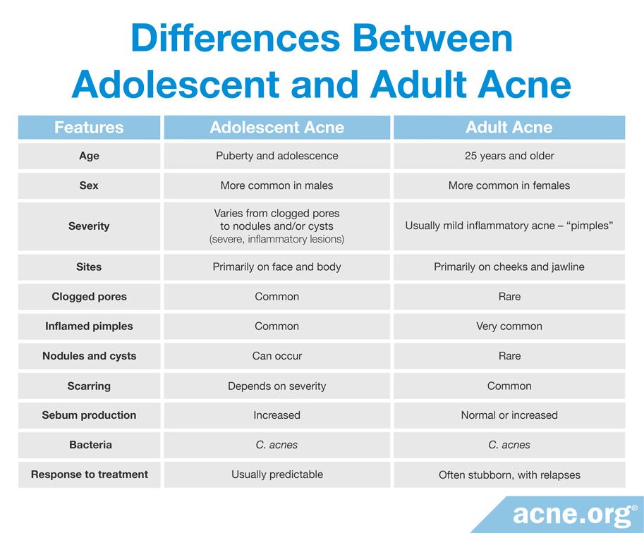 Differences Between Adolescent Acne and Adult Acne