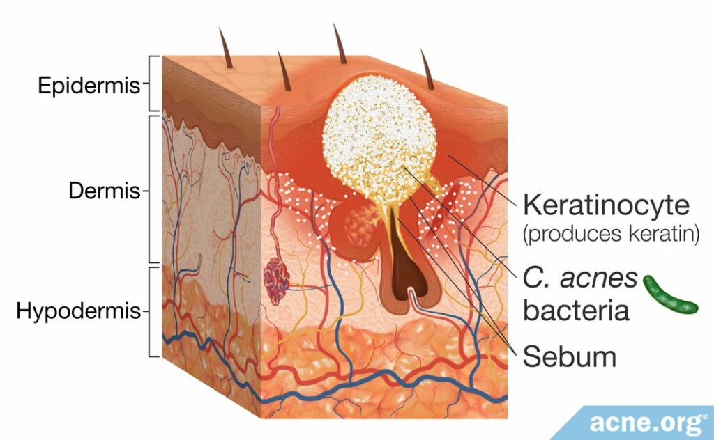 Sebum in the Skin