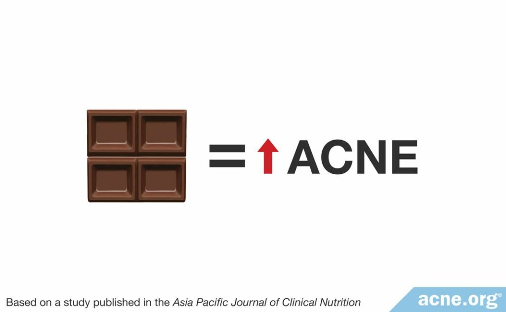 Chocolate increases acne