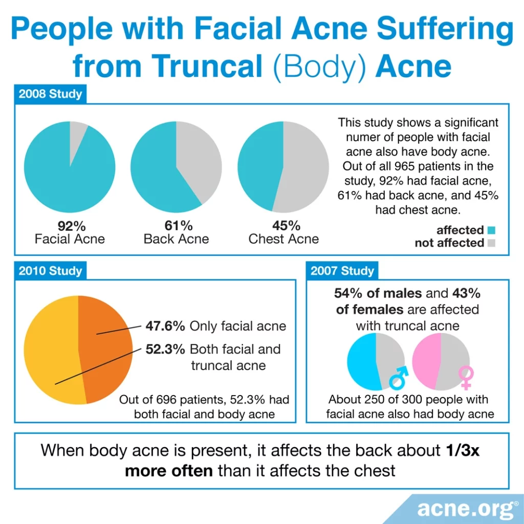 Personas con acné facial que sufren de acné troncal (cuerpo)