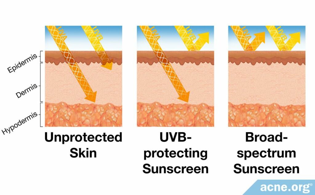 Unprotected Skin vs. Sunscreen-protected Skin