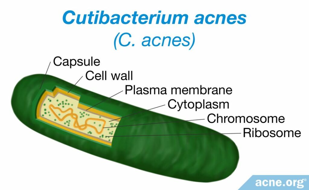 Cutibacterium acnes (C. acnes)