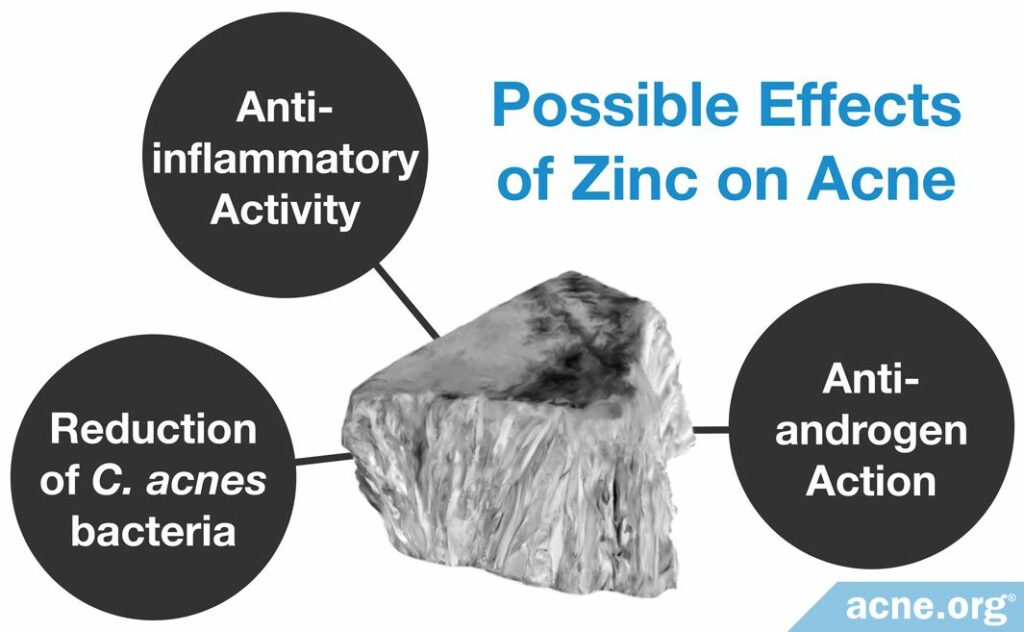 Possible Effects of Zinc on Acne