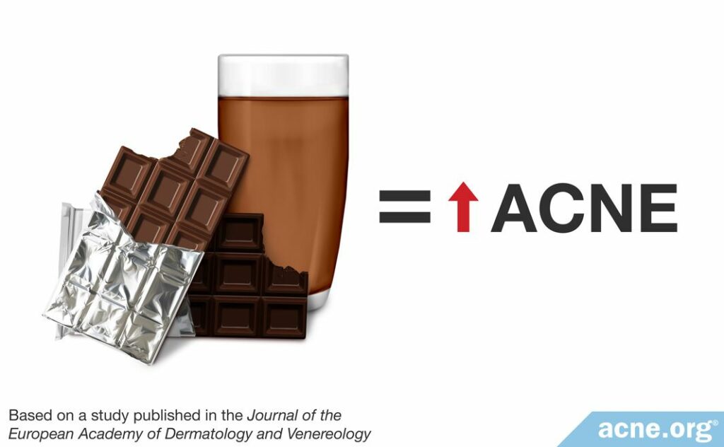 Chocolate increases acne