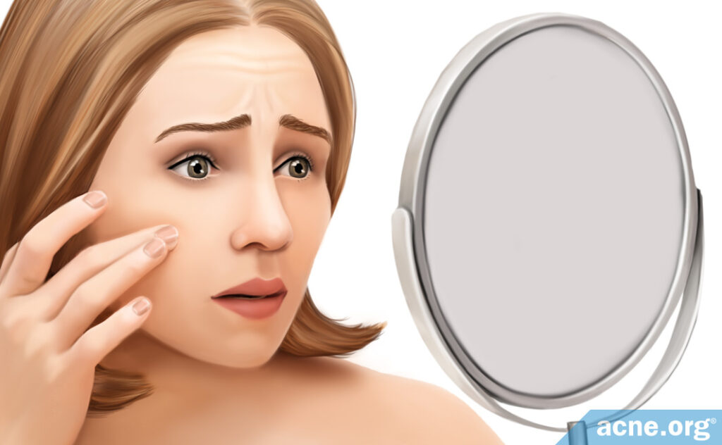 What is Acne Archives Page 6 of 6