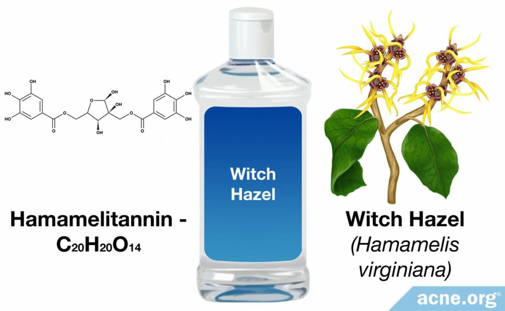 Can Witch Hazel Help Acne?