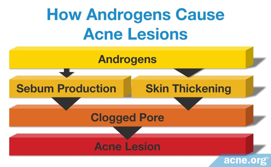 How Androgens Cause Acne Lesions