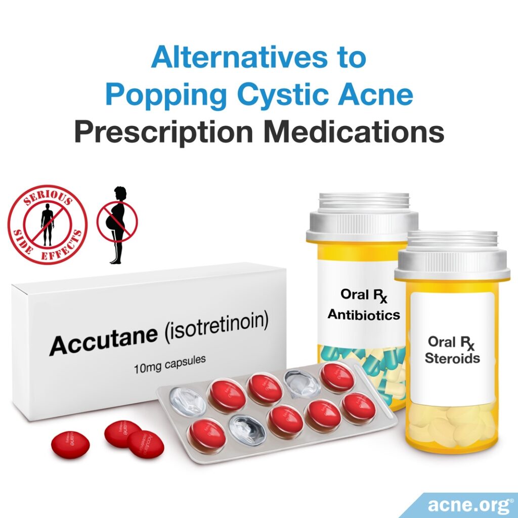 Alternatives to Popping Cystic Acne - Prescription Medications