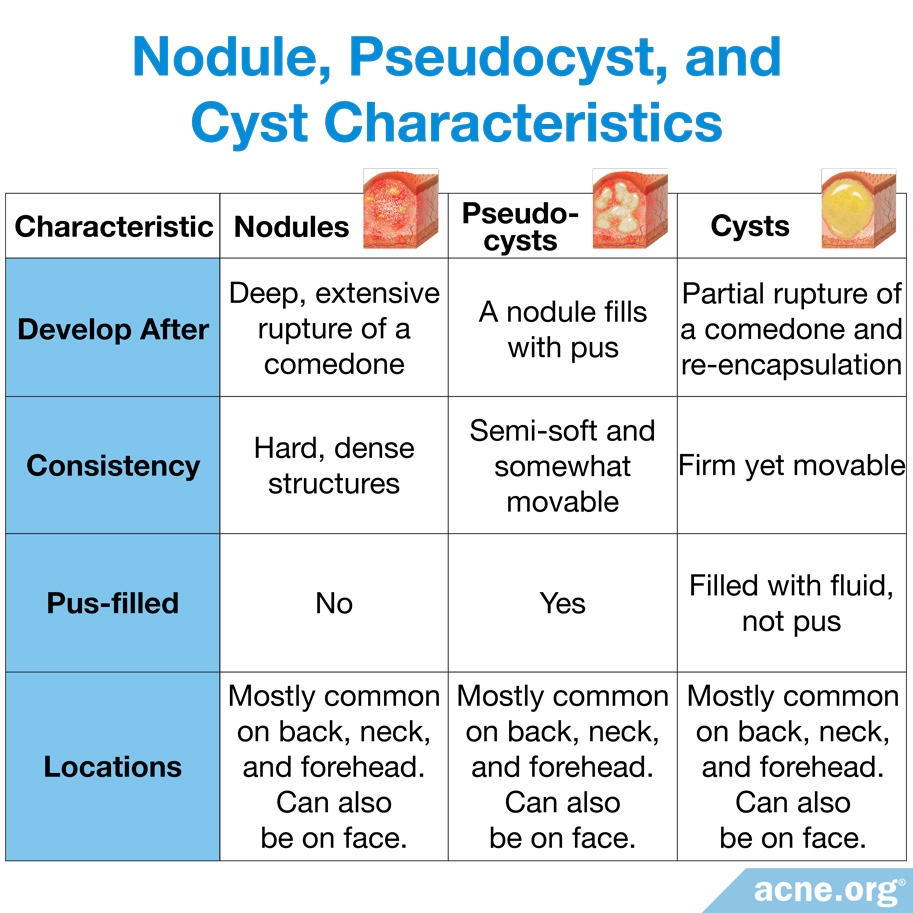 Nodule, Pseudocyst, and Cyst Characteristics