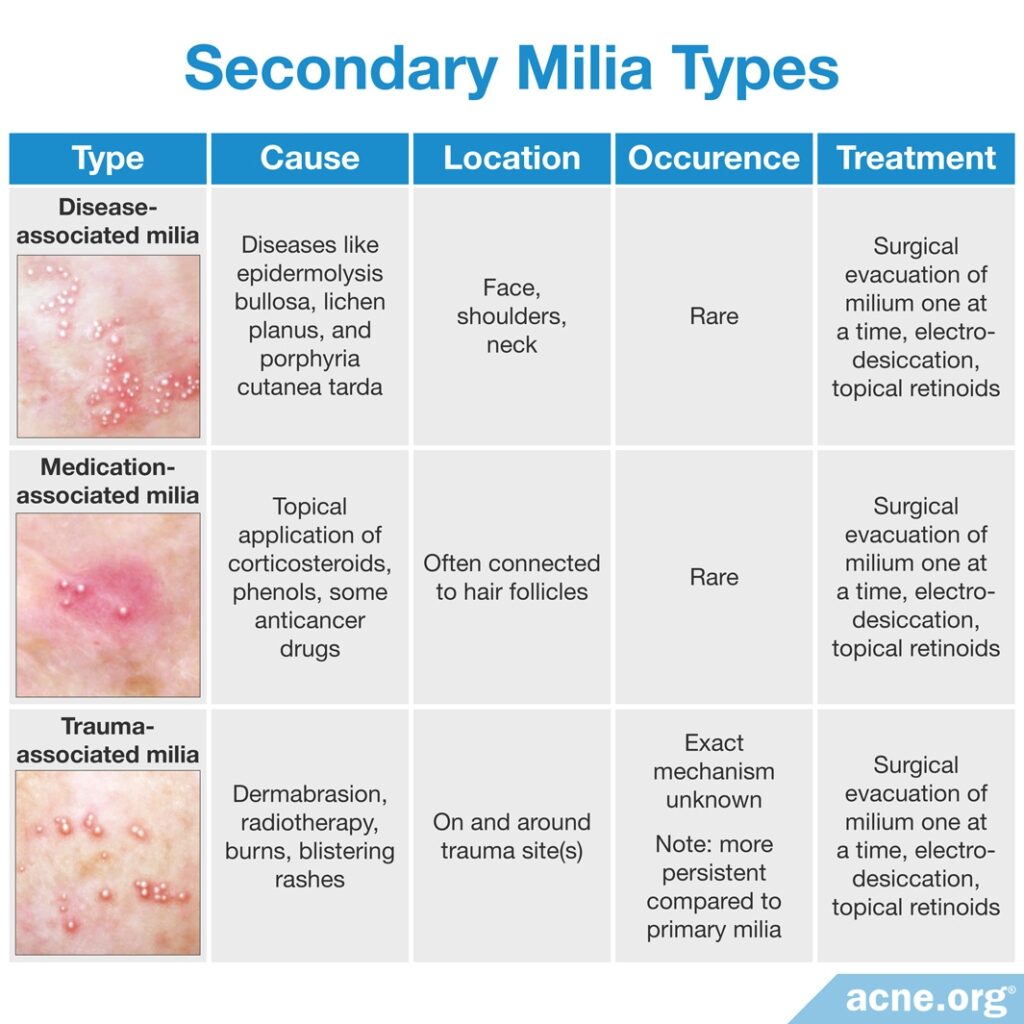 Secondary Milia Types