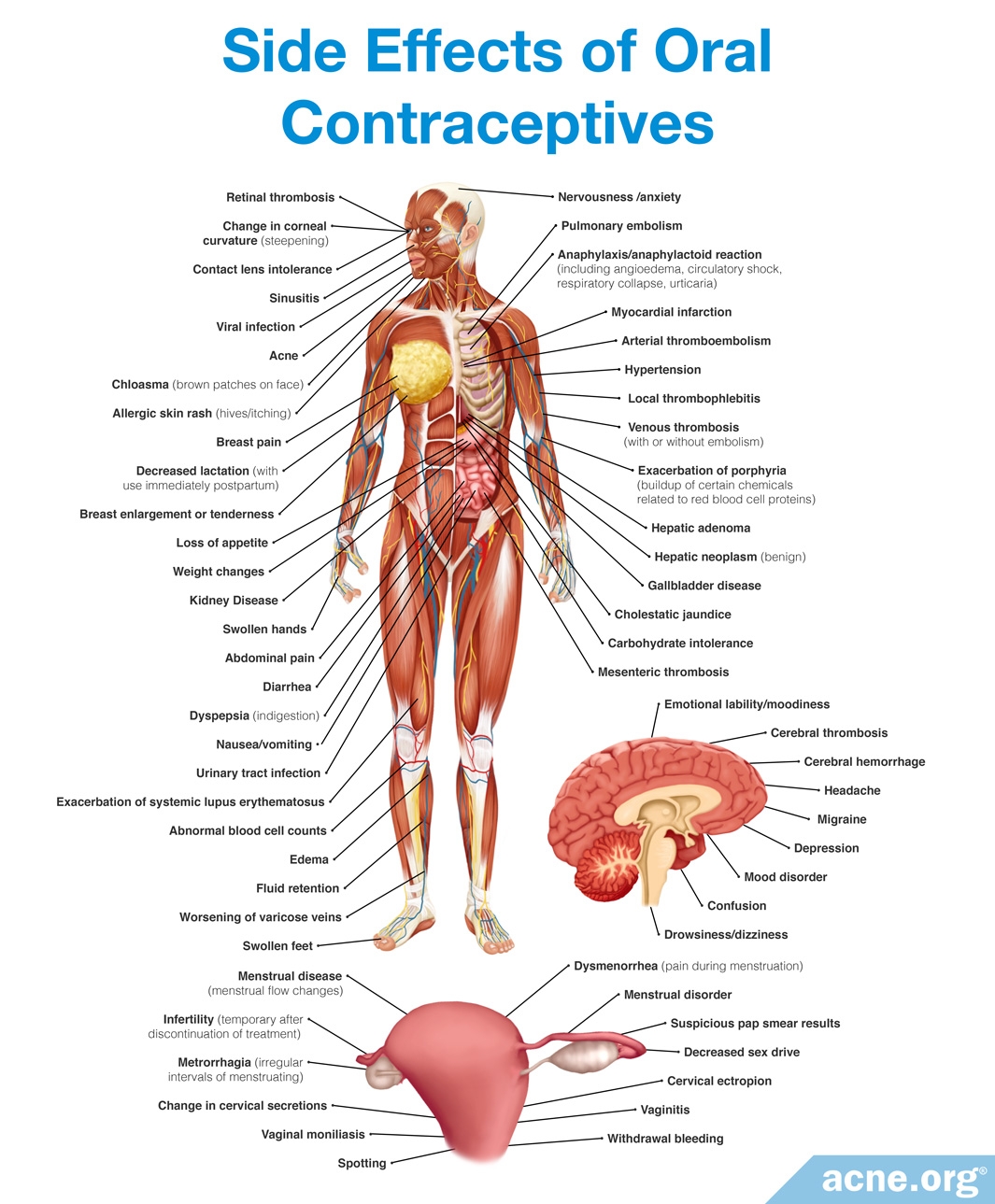 Side Effects of Oral Contraceptives