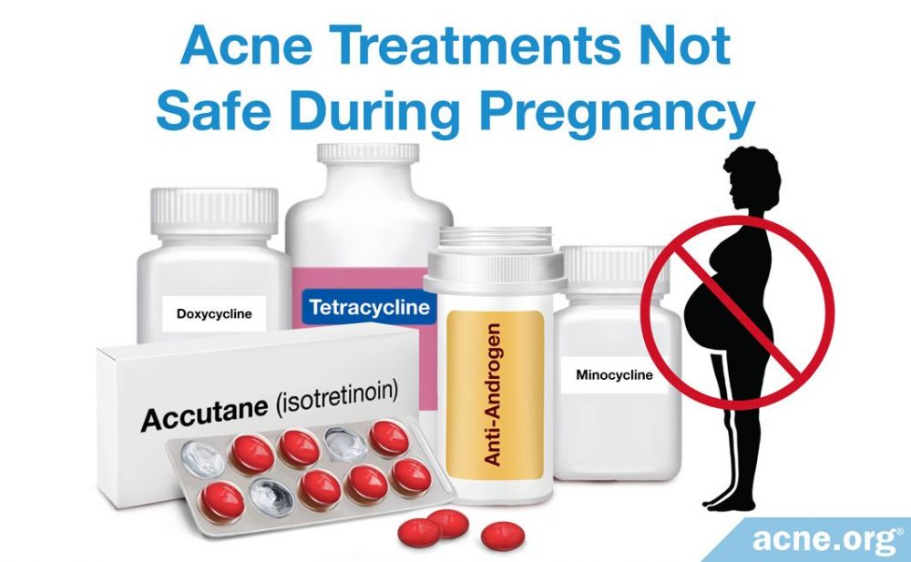Acne Treatments Not Safe During Pregnancy