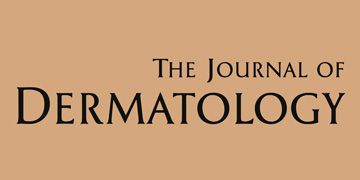 The Journal of Dermatology