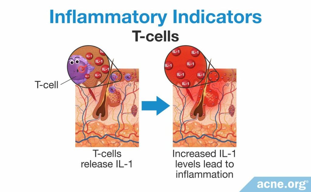 Inflammatory Indicators T-cells