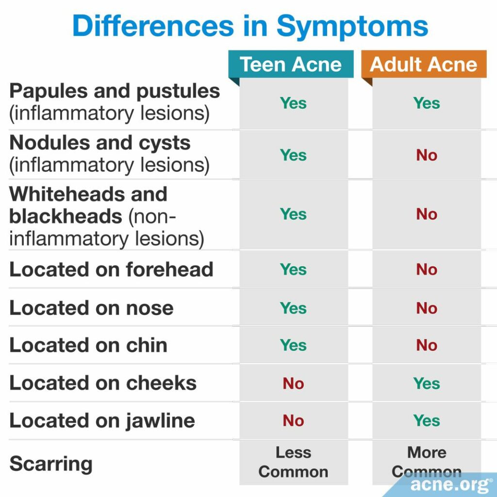 Differences in Symptoms Between Teen and Adult Acne