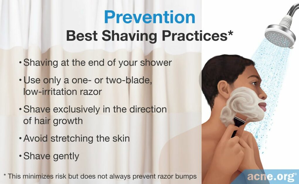 What Are Razor Bumps? - Acne.org