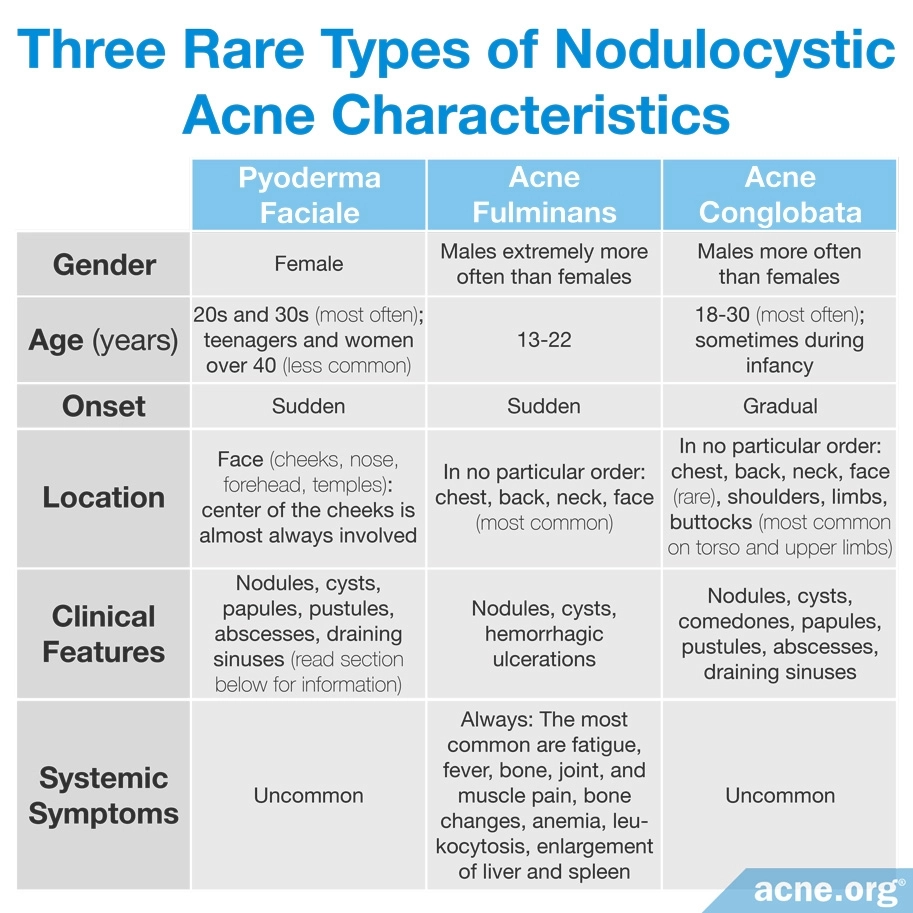 Tres tipos raros de características del acné noduloquístico