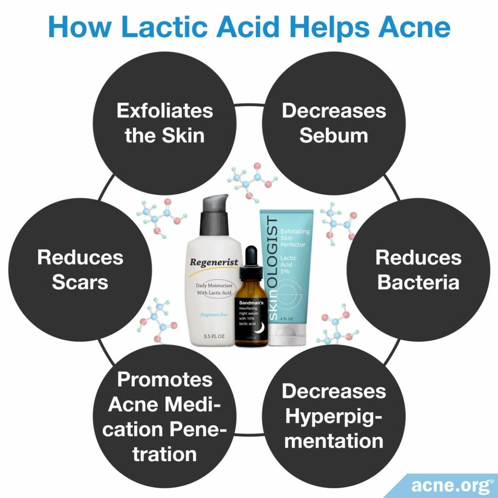 How Lactic Acid Helps Acne