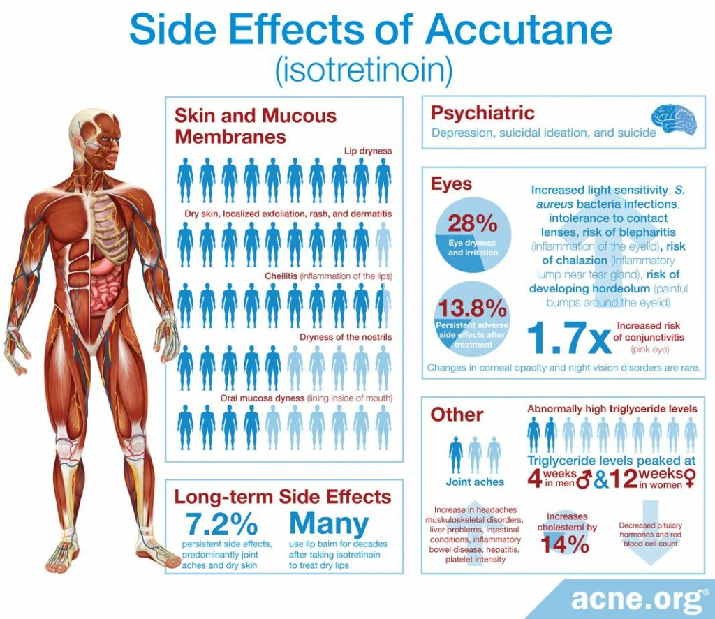 Side Effects of Accutane (Isotretinoin)