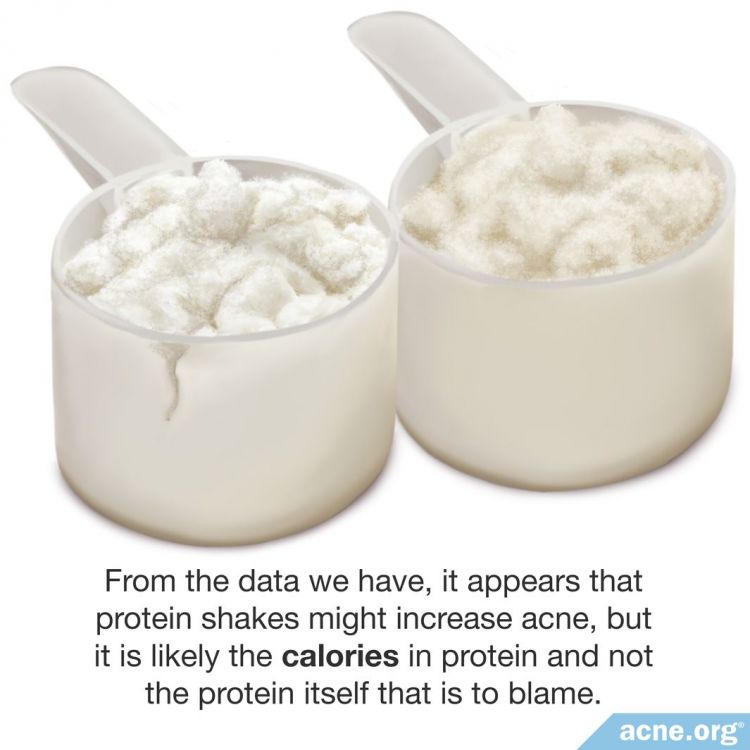 Protein Shakes Might Increase Acne