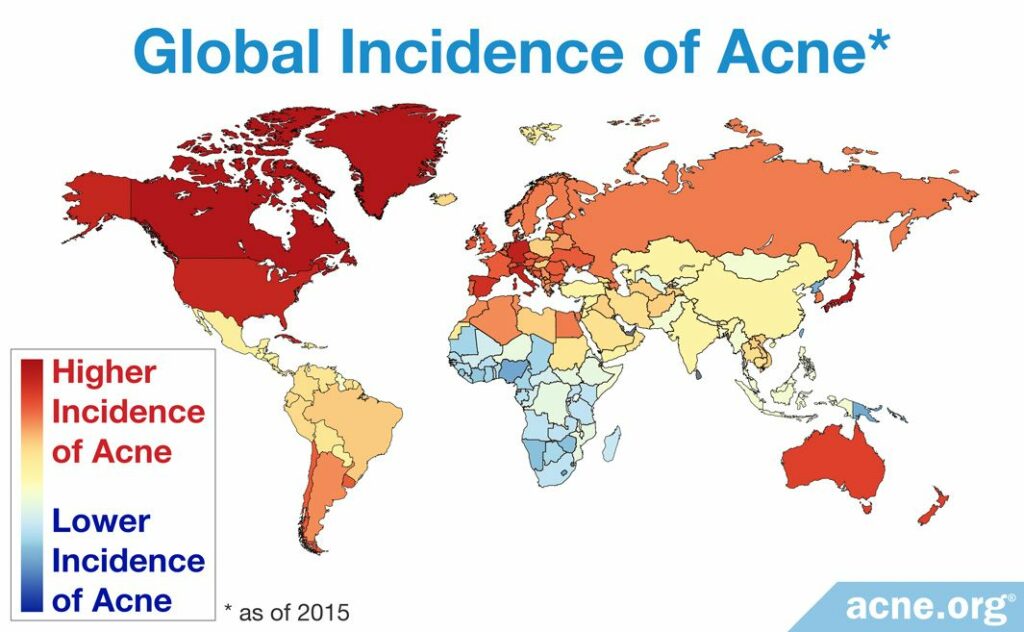 Global Incidence of Acne