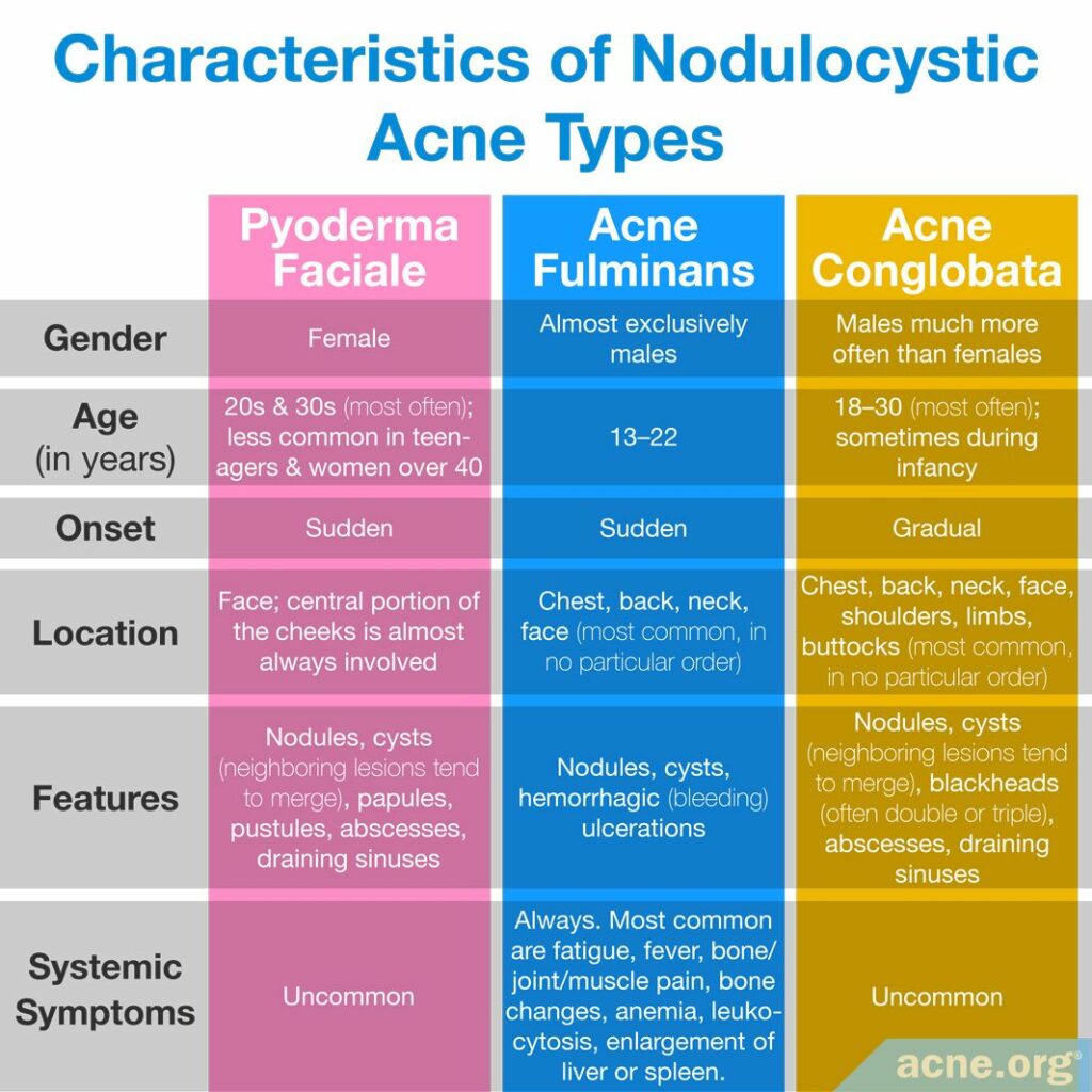 Characteristics of Nodulocystic Acne Types