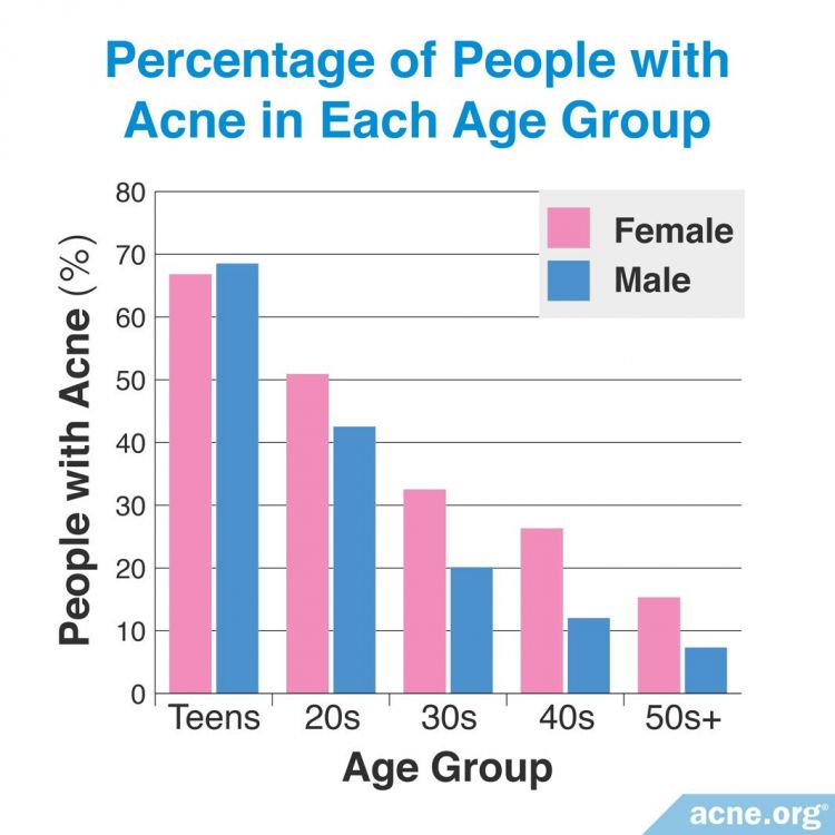 Percentage of people with acne in each age group