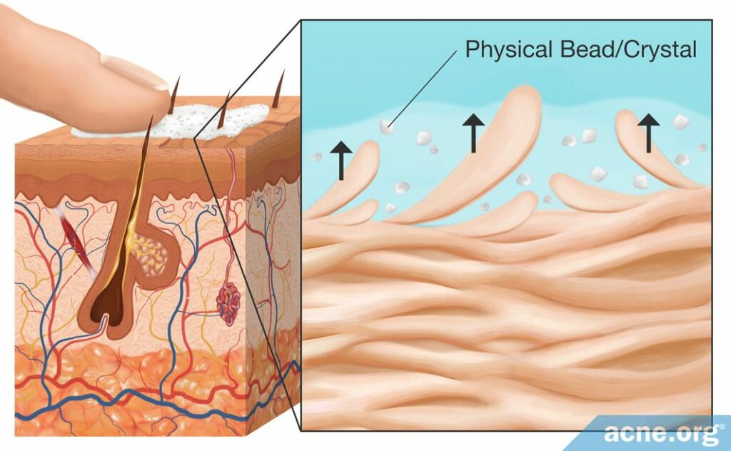 Physical Bead or Crystal Skin Exfoliation