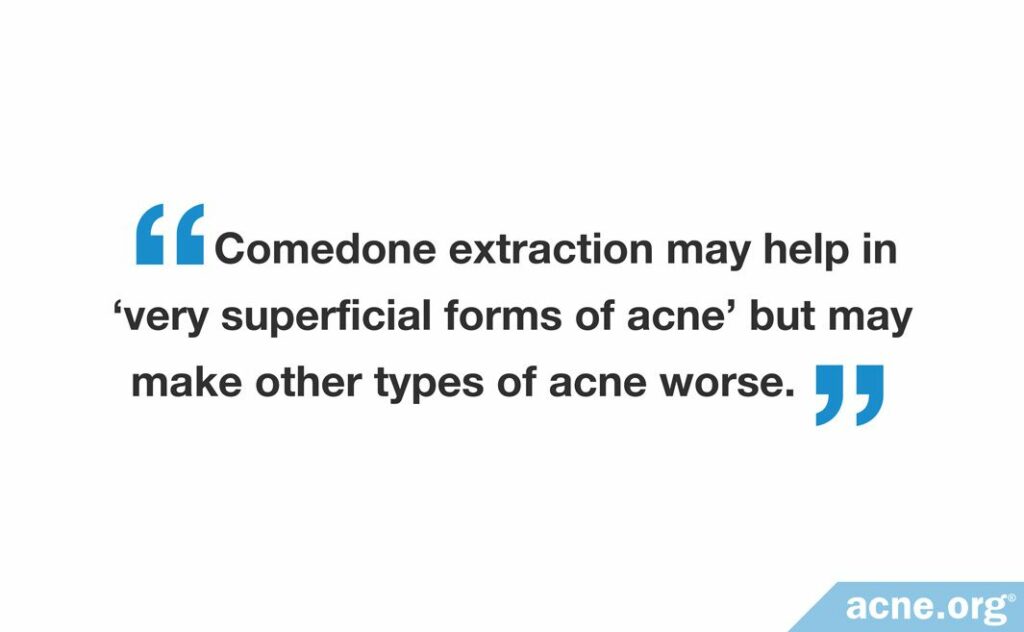 Comedone extraction may help in "very superficial forms of acne" but may make other types of acne worse.