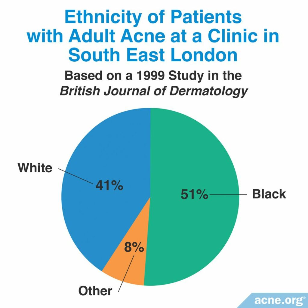 Ethnicity of Patients with Adult Acne at a Clinic in South East London