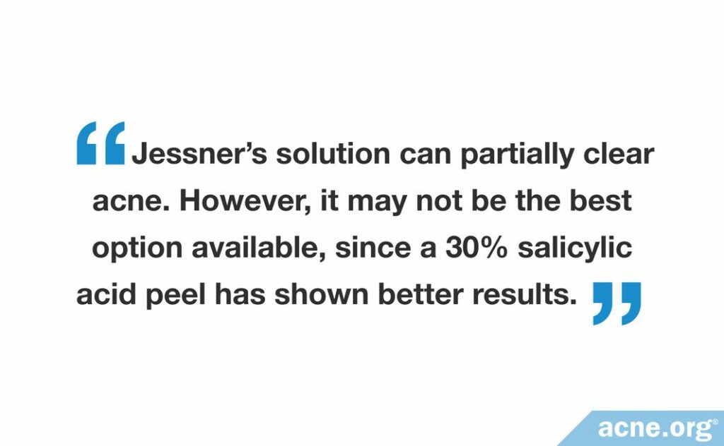 Jessner's solution can partially clear acne. However, it may not be the best option available, since a 30% salicylic acid peel has shown better results