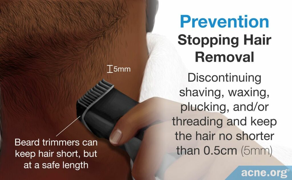 Stopping Hair Removal