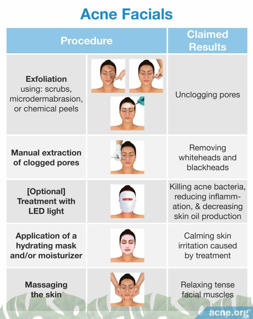 Acne Facials