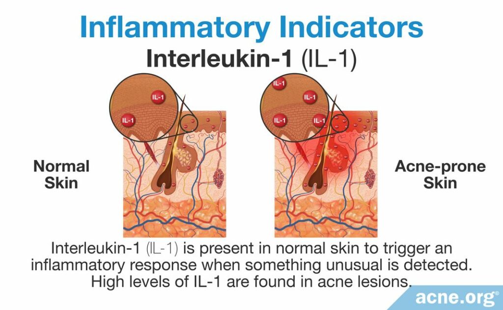 Inflammatory Indiciators Interleukin-1 (IL-1)